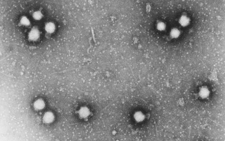 Crimean-Congo fever Virus