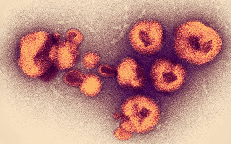 Lassa Virus