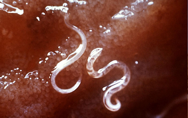 Parasitic Worms